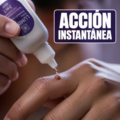 TRATAMIENTO PARA LAS VERRUGAS LUMINIX